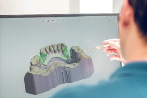DtDental Blog CAD CAM 3D odontología